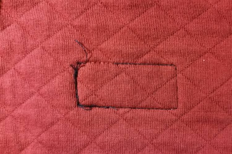 The thread is cut and some of it has been pulled out with tweezers The thread is cut and some of it has been pulled out with tweezers